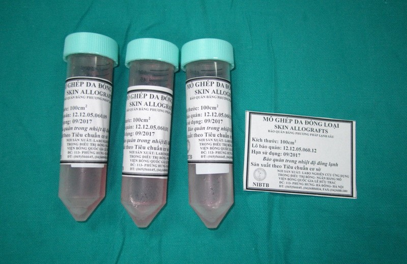 Bảo quản da đồng loại bằng phương pháp lạnh sâu điều trị bệnh nhân bỏng