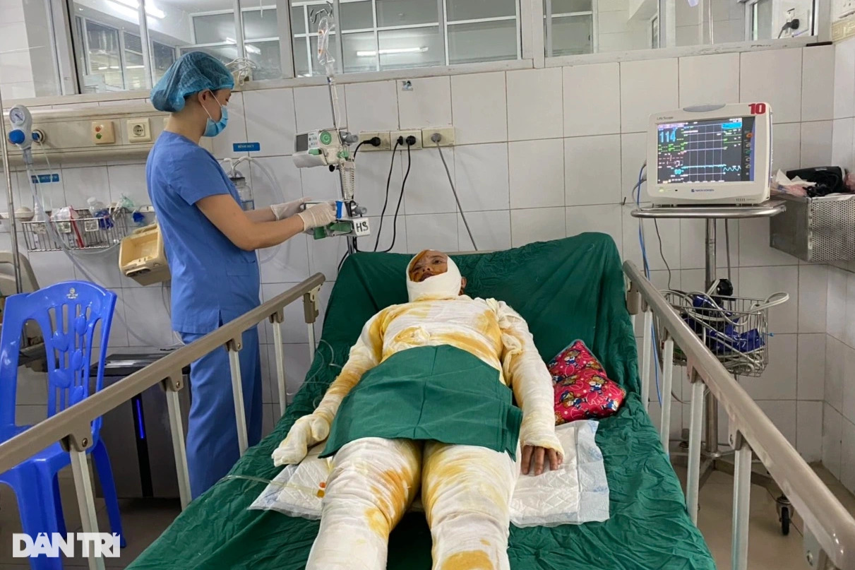 Xót xa gia cảnh vợ chồng người nông dân bị bỏng do dùng xăng đốt rơm