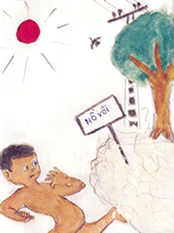 Tai nạn bỏng trẻ em có thể phòng tránh được 