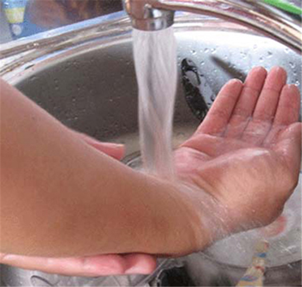 HỎI VỀ ĐIỀU TRỊ SẸO PHÌ ĐẠI SAU BỎNG