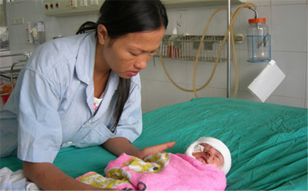 Cảnh báo: Tai nạn bỏng lửa do sưởi ấm trong mùa rét gia tăng 