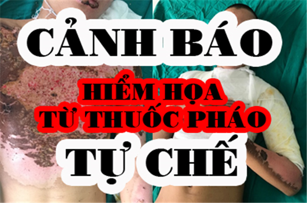 Cảnh báo - Hiểm họa từ thuốc pháo tự chế